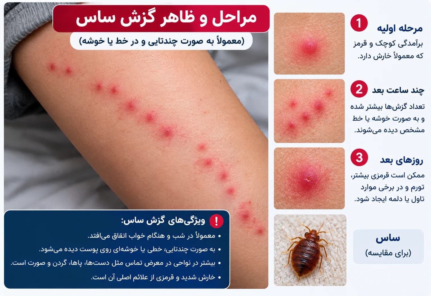سمپاشی ساس